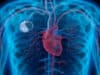 Managing life with a pacemaker