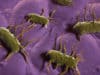 Researchers discover way to disarm potentially deadly Listeria bacteria
