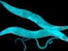 Iron and the aging brain
