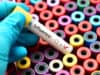 Growing flu viruses in specialised cells