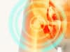 60% of osteoarthritis sufferers see improvement
