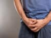 Most commonly asked questions about testicular cancer
