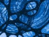 Five types of bacteria linked to aggressive prostate cancer