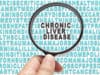 Liver disease: New non-invasive method of risk assessment