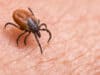 Ticks weaken skin’s immune response