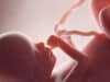 Babies have air pollution particles in their lungs and brains