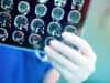 Head and neck cancer: Markers to facilitate better treatment