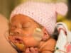 WHO: immediate skin to skin care for survival