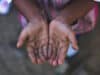 Urgent action needed as “child wasting” threatens millions