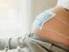 Covid-19 in pregnant women can damage the placenta and the foetus