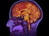 Reducing inflammation in rheumatoid arthritis