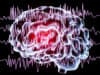 Microbot development could help treat seizures