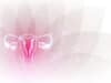 Genetic study of endometriosis reveals clues to better treatment
