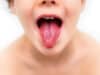 Streptococcal infections
