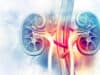 Major clinical trial set to change kidney transplant practice