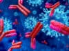 Immunosuppressed are least likely to have COVID-19 antibodies