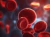 Red blood cell particles reduce fat deposition in arteries