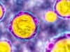 Gut inflammation caused by substance secreted by microbe