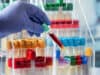 Biobank for children with genetic muscle diseases