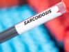 New insights into the development of sarcoidosis