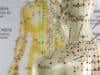 First acupuncture clinic for cancer patients