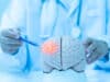 A thyroxine derivative enhances brain drug delivery