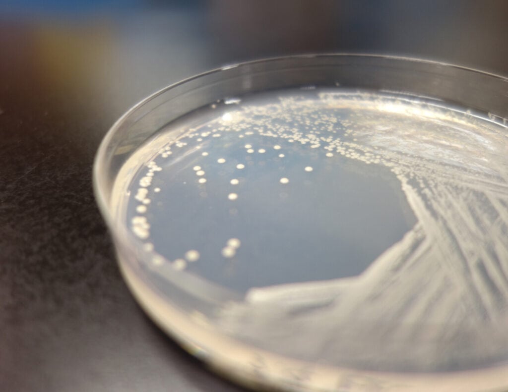 yeast