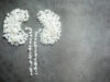 How to Keep Your Kidneys Healthy When You Have Diabetes