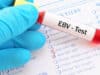 Multiple sclerosis and Epstein-Barr virus: Possible basis for vaccine
