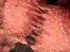 New insight into combatting drug-resistant prostate cancer