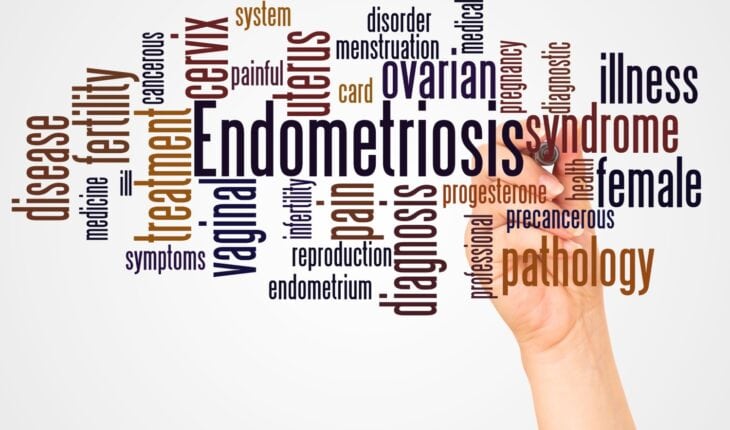 Endometriosis poses substantial burden