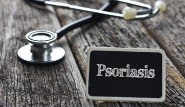 psoriasis