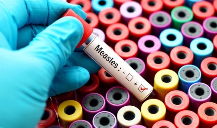 Earlier measles vaccine